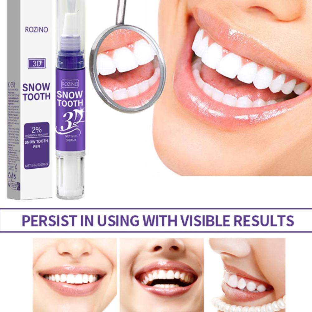 Penna sbiancante per denti 3D, - Teeth Whitening Near Me recensione e prezzo